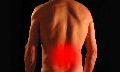 CBD OIL Help Relieve SCIATICA