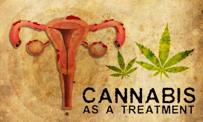 Cannabis as a Treatment for Endometriosis