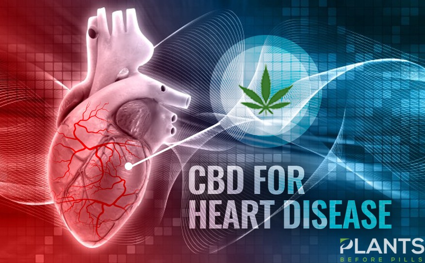 CBD for Heart Disease, Medical Marijuana