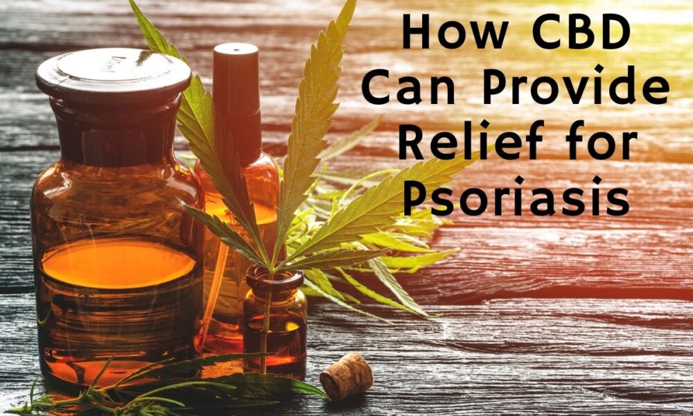How CBD Can Provide Relief for Psoriasis