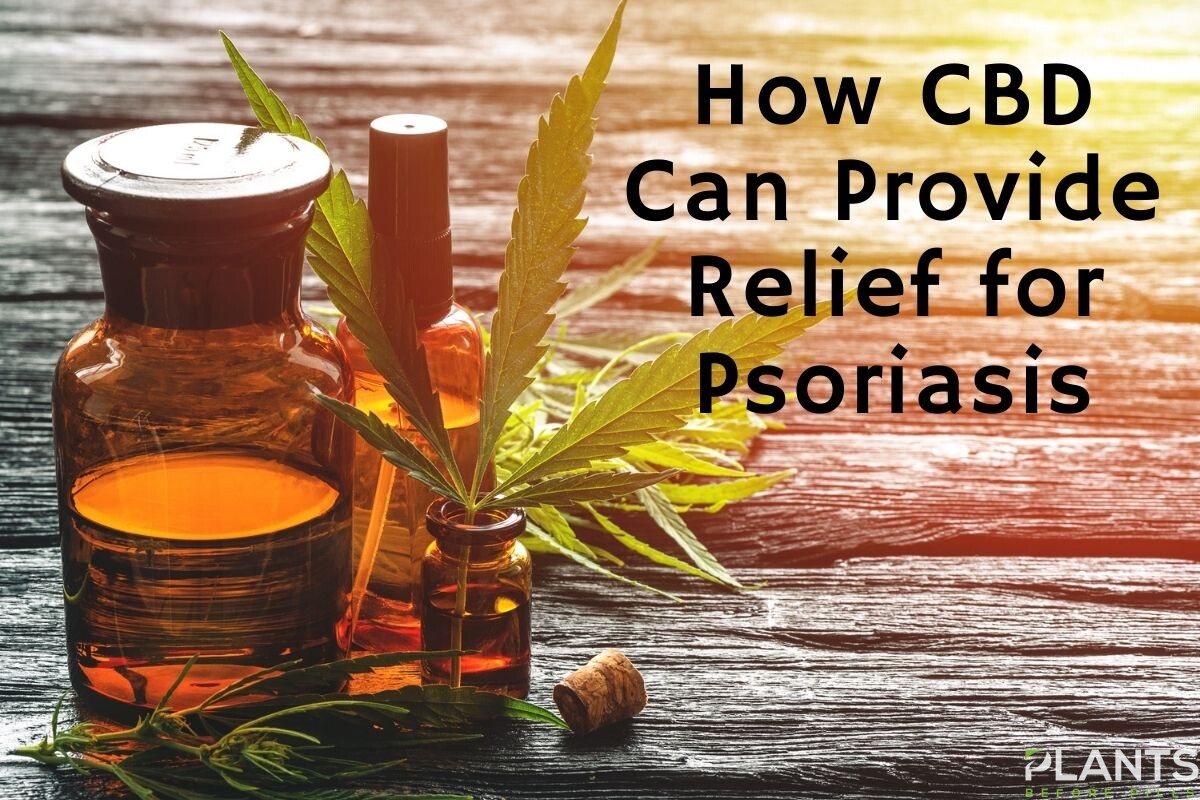 How CBD Can Provide Relief for Psoriasis