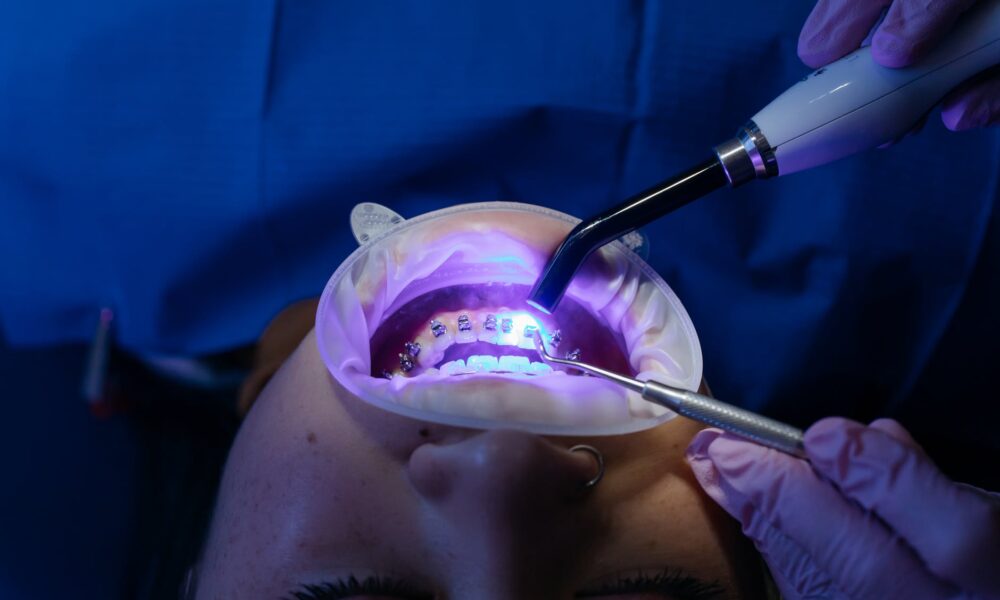 Oral Health Benefits of CBD